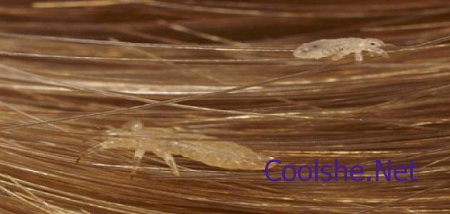 تفسير ابن سيرين حلم القمل للنساء والرجال كل شيء